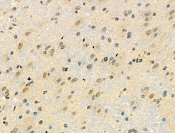 Invitrogen Phospho-E2F1 (Ser364) Polyclonal Antibody 100 &mu;L | Buy Online | Invitrogen&trade; | Fisher Scientific