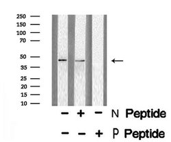 Invitrogen Phospho-E2F1 (Ser364) Polyclonal Antibody 100 &mu;L | Buy Online | Invitrogen&trade; | Fisher Scientific