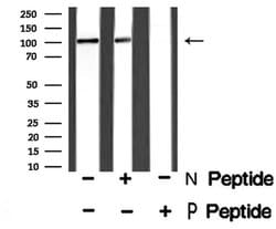 Invitrogen Phospho-GABBR2 (Ser884) Polyclonal Antibody 100 μL; Unconjugated:Antibodies,