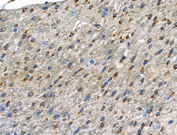 Invitrogen Phospho-GABBR2 (Ser893) Polyclonal Antibody 100 μL; Unconjugated:Antibodies,