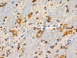Invitrogen Phospho-GABBR2 (Ser893) Polyclonal Antibody 100 μL; Unconjugated:Antibodies,