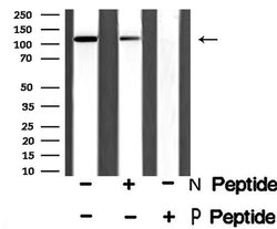 Invitrogen Phospho-GABBR2 (Ser893) Polyclonal Antibody 100 μL; Unconjugated:Antibodies,