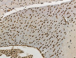 Invitrogen Phospho-HNRNPA0 (Ser84) Polyclonal Antibody 100 μL; Unconjugated:Antibodies,