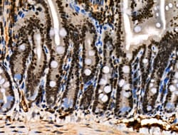 Invitrogen Phospho-HNRNPA0 (Ser84) Polyclonal Antibody 100 μL; Unconjugated:Antibodies,