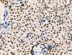 Invitrogen Phospho-HNRNPA0 (Ser84) Polyclonal Antibody 100 μL; Unconjugated:Antibodies,