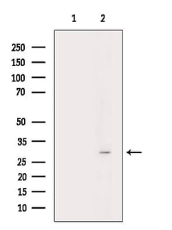Invitrogen Phospho-HNRNPA0 (Ser84) Polyclonal Antibody 100 μL; Unconjugated:Antibodies,