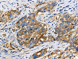 Invitrogen Phospho-ITGB1 (Tyr783) Polyclonal Antibody 100 &mu;L; Unconjugated:Antibodies,