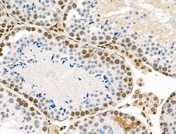 Invitrogen Phospho-PRC1 (Thr481) Polyclonal Antibody 100 μL; Unconjugated:Antibodies,
