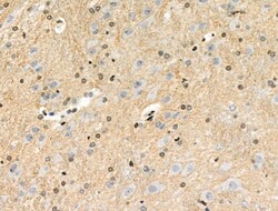 Invitrogen Phospho-PRC1 (Thr481) Polyclonal Antibody 100 μL; Unconjugated:Antibodies,