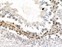 Invitrogen Phospho-PRC1 (Thr481) Polyclonal Antibody 100 μL; Unconjugated:Antibodies,