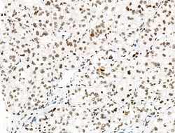 Invitrogen Phospho-PRC1 (Thr481) Polyclonal Antibody 100 μL; Unconjugated:Antibodies,