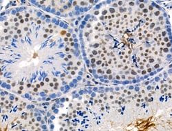 Invitrogen Phospho-PKC alpha (Thr497) Polyclonal Antibody 100 &mu;L; Unconjugated:Antibodies,