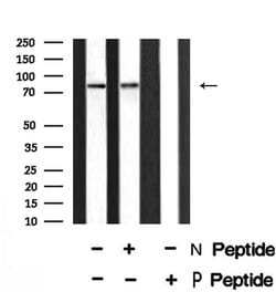 Invitrogen Phospho-PKC alpha (Thr497) Polyclonal Antibody 100 &mu;L; Unconjugated:Antibodies,