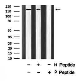 Invitrogen Phospho-ROCK2 (Tyr722) Polyclonal Antibody 100 &mu;L | Buy Online | Invitrogen&trade; | Fisher Scientific