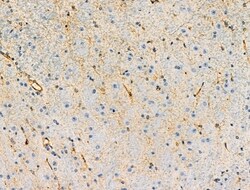 Invitrogen Phospho-ROCK2 (Tyr722) Polyclonal Antibody 100 &mu;L | Buy Online | Invitrogen&trade; | Fisher Scientific