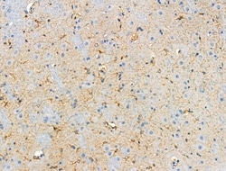 Invitrogen Phospho-ROCK2 (Tyr722) Polyclonal Antibody 100 &mu;L | Buy Online | Invitrogen&trade; | Fisher Scientific