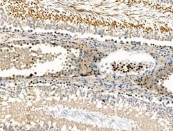 Invitrogen Phospho-Androgen Receptor (Ser792) Polyclonal Antibody 100 &mu;L | Buy Online | Invitrogen&trade; | Fisher Scientific