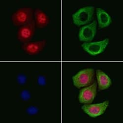 Invitrogen Phospho-Androgen Receptor (Ser792) Polyclonal Antibody 100 &mu;L | Buy Online | Invitrogen&trade; | Fisher Scientific