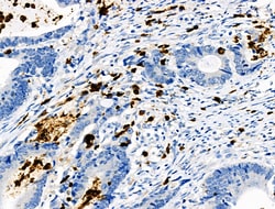 Invitrogen Phospho-CEACAM1 (Ser508) Polyclonal Antibody 100 &mu;L | Buy Online | Invitrogen&trade; | Fisher Scientific