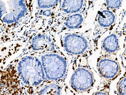 Invitrogen Phospho-CEACAM1 (Ser508) Polyclonal Antibody 100 &mu;L | Buy Online | Invitrogen&trade; | Fisher Scientific