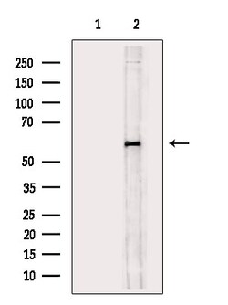Invitrogen Phospho-CEACAM1 (Ser508) Polyclonal Antibody 100 &mu;L | Buy Online | Invitrogen&trade; | Fisher Scientific
