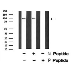 Invitrogen Phospho-CSF1R (Tyr921) Polyclonal Antibody 100 &mu;L; Unconjugated:Antibodies,