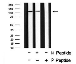 Invitrogen Phospho-EphA1 (Tyr599) Polyclonal Antibody 100 &mu;L; Unconjugated:Antibodies,