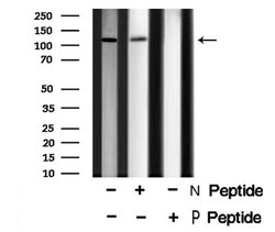 Phospho-EphA1 (Tyr605) Polyclonal Antibody, Invitrogen 100 &mu;L; Unconjugated:Antibodies,