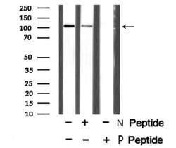 Invitrogen Phospho-EphA3 (Tyr602) Polyclonal Antibody 100 &mu;L; Unconjugated:Antibodies,