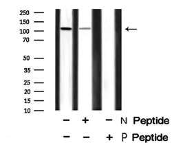 Invitrogen Phospho-EphA7 (Tyr608) Polyclonal Antibody 100 &mu;L; Unconjugated:Antibodies,