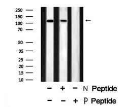 Invitrogen Phospho-EphB1 (Tyr928) Polyclonal Antibody 100 &mu;L; Unconjugated:Antibodies,