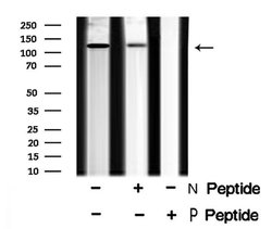 Invitrogen Phospho-EphB1/EphB2 (Tyr778, Tyr780) Polyclonal Antibody 100
