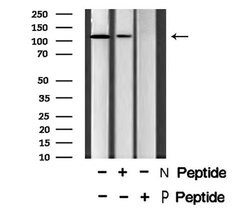 Invitrogen Phospho-EphB4 (Tyr987) Polyclonal Antibody 100 &mu;L; Unconjugated:Antibodies,