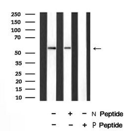 Invitrogen Phospho-EpoR (Tyr426) Polyclonal Antibody 100 &mu;L; Unconjugated:Antibodies,