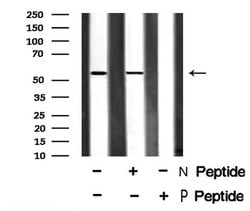 Invitrogen Phospho-EpoR (Tyr456) Polyclonal Antibody 100 μL; Unconjugated:Antibodies,