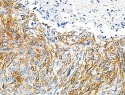 Invitrogen Phospho-FGFR3 (Tyr724) Polyclonal Antibody 100 &mu;L; Unconjugated:Antibodies,