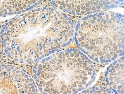 Invitrogen Phospho-FGFR3 (Tyr724) Polyclonal Antibody 100 &mu;L; Unconjugated:Antibodies,