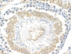 Invitrogen Phospho-FGFR3 (Tyr724) Polyclonal Antibody 100 &mu;L; Unconjugated:Antibodies,