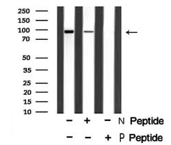 Invitrogen Phospho-FGFR3 (Tyr724) Polyclonal Antibody 100 &mu;L; Unconjugated:Antibodies,