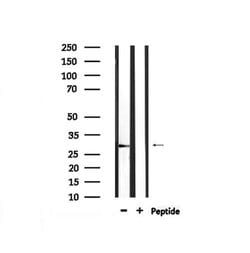 Invitrogen Phospho-LAT (Tyr255) Polyclonal Antibody 100 μL; Unconjugated:Antibodies,