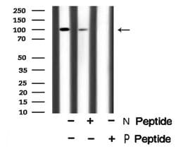 Invitrogen Phospho-ROR1 (Tyr786) Polyclonal Antibody 100 &mu;L; Unconjugated:Antibodies,