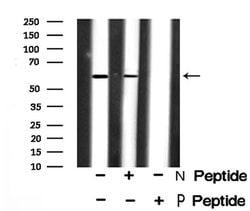 Invitrogen Phospho-SMAD3 (Ser423) Polyclonal Antibody 100 &mu;L; Unconjugated:Antibodies,