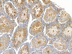 Invitrogen Phospho-BCL-2 (Thr74) Polyclonal Antibody 100 &mu;L; Unconjugated:Antibodies,