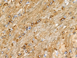Invitrogen Phospho-BCL-2 (Thr74) Polyclonal Antibody 100 &mu;L; Unconjugated:Antibodies,