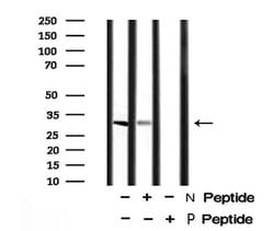 Invitrogen Phospho-BCL-2 (Thr74) Polyclonal Antibody 100 &mu;L; Unconjugated:Antibodies,