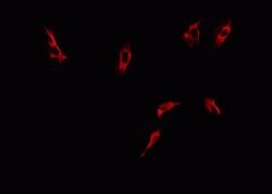 Invitrogen Phospho-DNM1L (Ser616) Polyclonal Antibody 100 &mu;L; Unconjugated:Antibodies,