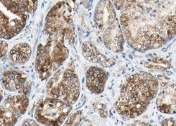 Invitrogen Phospho-DNM1L (Ser616) Polyclonal Antibody 100 &mu;L; Unconjugated:Antibodies,