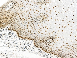 Invitrogen Phospho-eIF2 beta (Ser2) Polyclonal Antibody 100 &mu;L; Unconjugated:Antibodies,