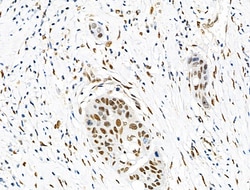 Invitrogen Phospho-eIF2 beta (Ser2) Polyclonal Antibody 100 &mu;L; Unconjugated:Antibodies,