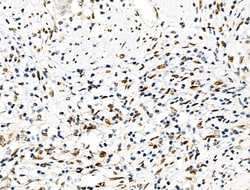 Invitrogen Phospho-eIF2 beta (Ser2) Polyclonal Antibody 100 &mu;L; Unconjugated:Antibodies,